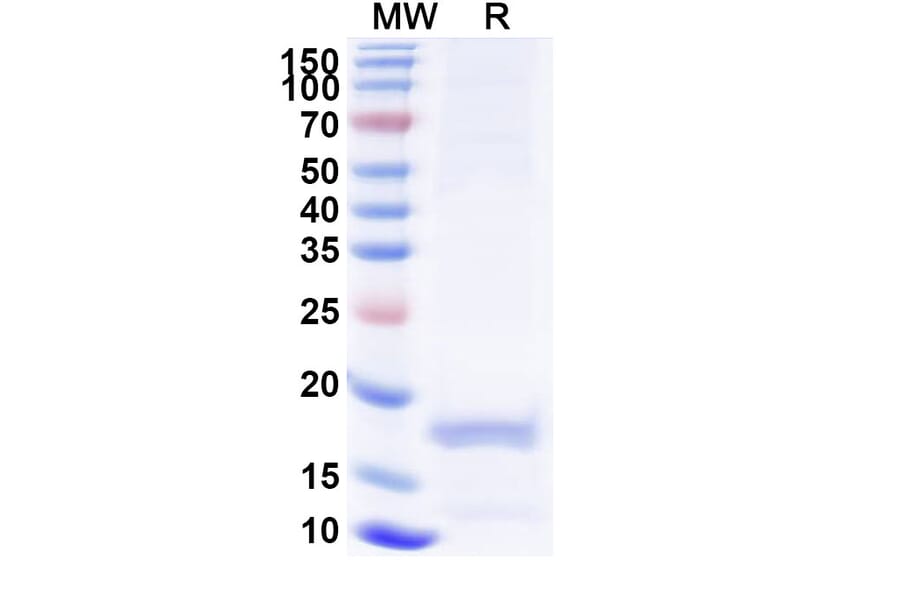 SDS-PAGE - Anti-porM Nanobody [SAA0959] (A338156) - Antibodies.com