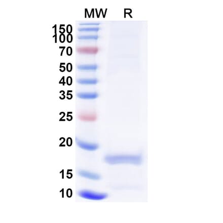 SDS-PAGE - Anti-porM Nanobody [SAA0959] (A338156) - Antibodies.com