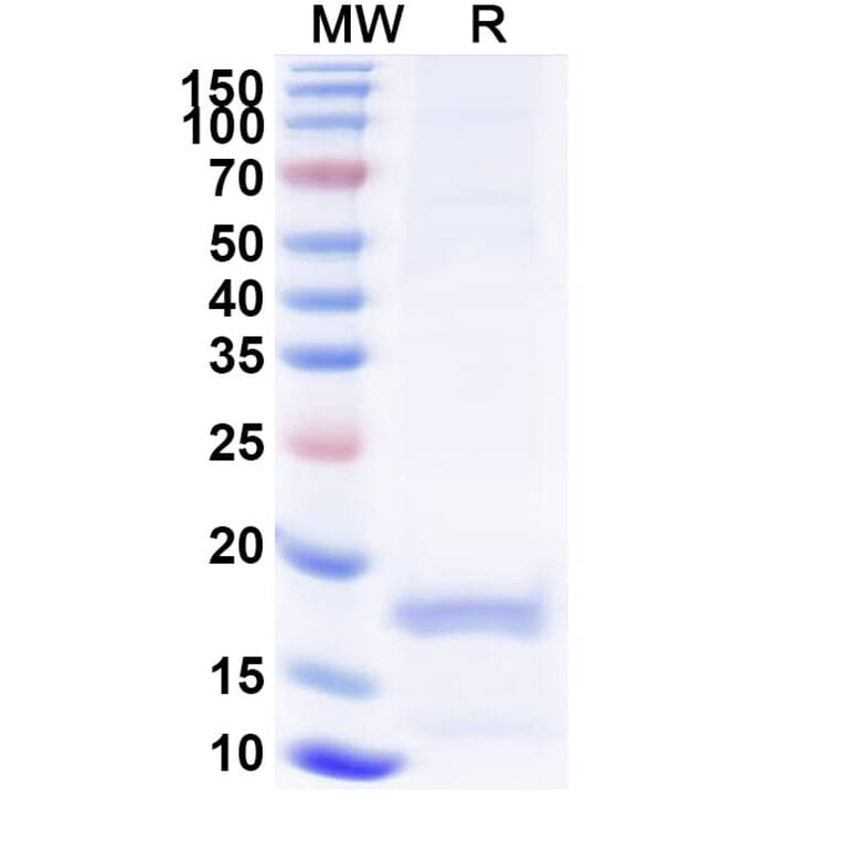 SDS-PAGE - Anti-porM Nanobody [SAA0959] (A338156) - Antibodies.com