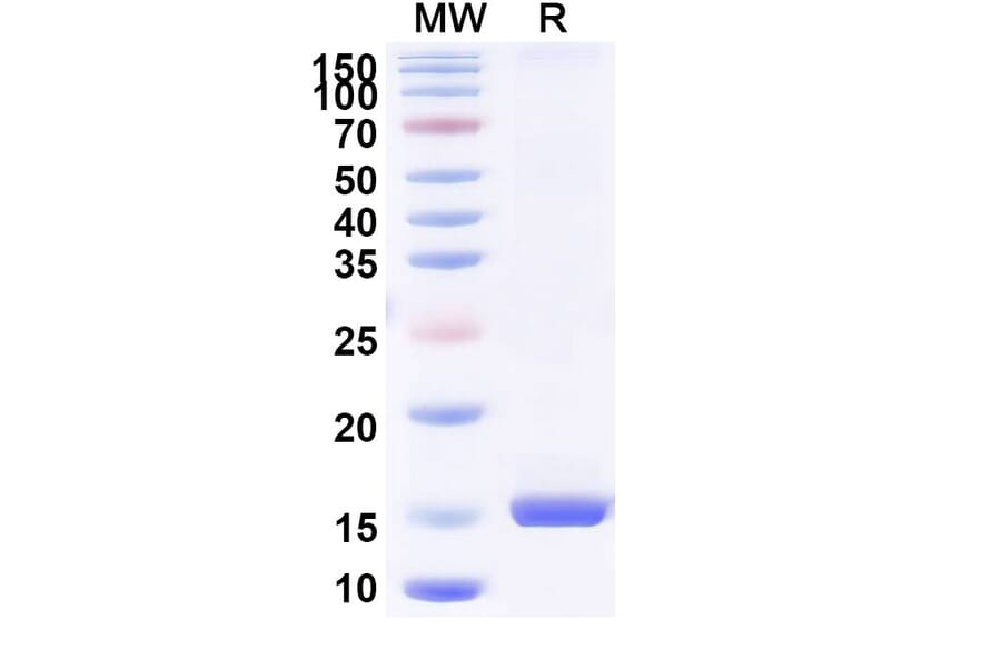 SDS-PAGE - Anti-porM Nanobody [SAA0966] (A338157) - Antibodies.com