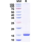 SDS-PAGE - Anti-porM Nanobody [SAA0966] (A338157) - Antibodies.com