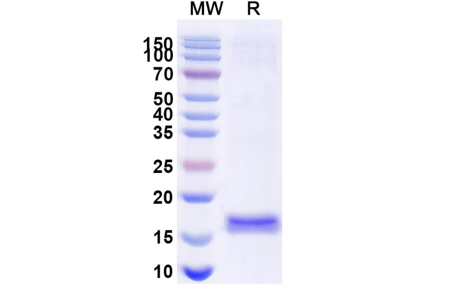 SDS-PAGE - Anti-porM Nanobody [SAA1181] (A338158) - Antibodies.com