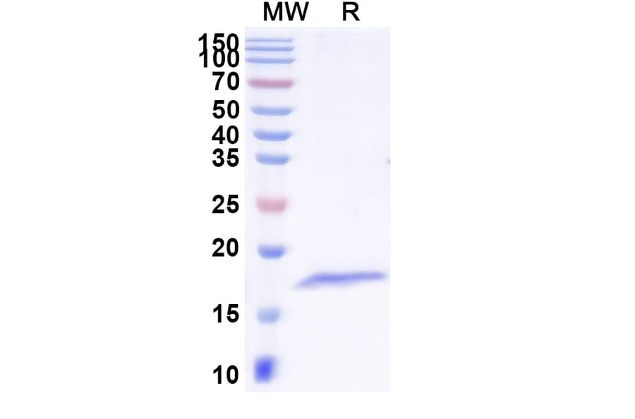 SDS-PAGE - Anti-Tetanus Toxin Nanobody [SAA1236] (A338161) - Antibodies.com