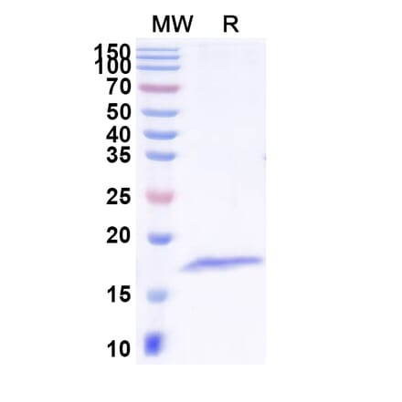 SDS-PAGE - Anti-Tetanus Toxin Nanobody [SAA1236] (A338161) - Antibodies.com