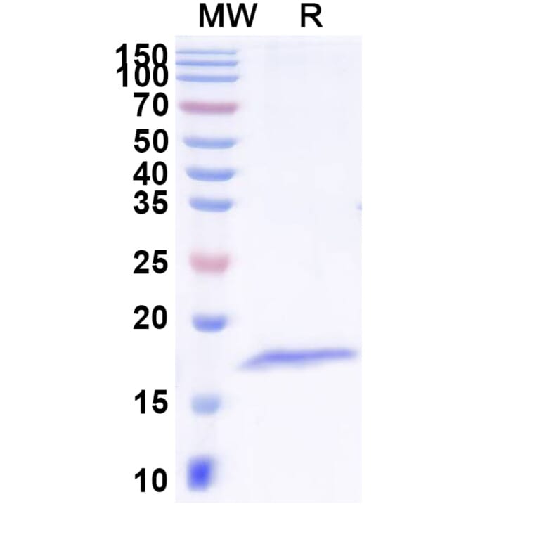 SDS-PAGE - Anti-Tetanus Toxin Nanobody [SAA1236] (A338161) - Antibodies.com