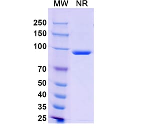 SDS-PAGE - Anti-Nucleoprotein Nanobody [SAA1402] (A338197) - Antibodies.com