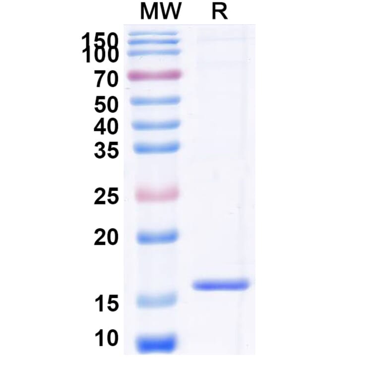 SDS-PAGE - Anti-beta Catenin Nanobody [SAA1410] (A338198) - Antibodies.com