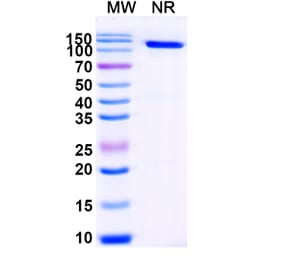 SDS-PAGE - Anti-Cortisol Nanobody [SAA1437] (A338206) - Antibodies.com