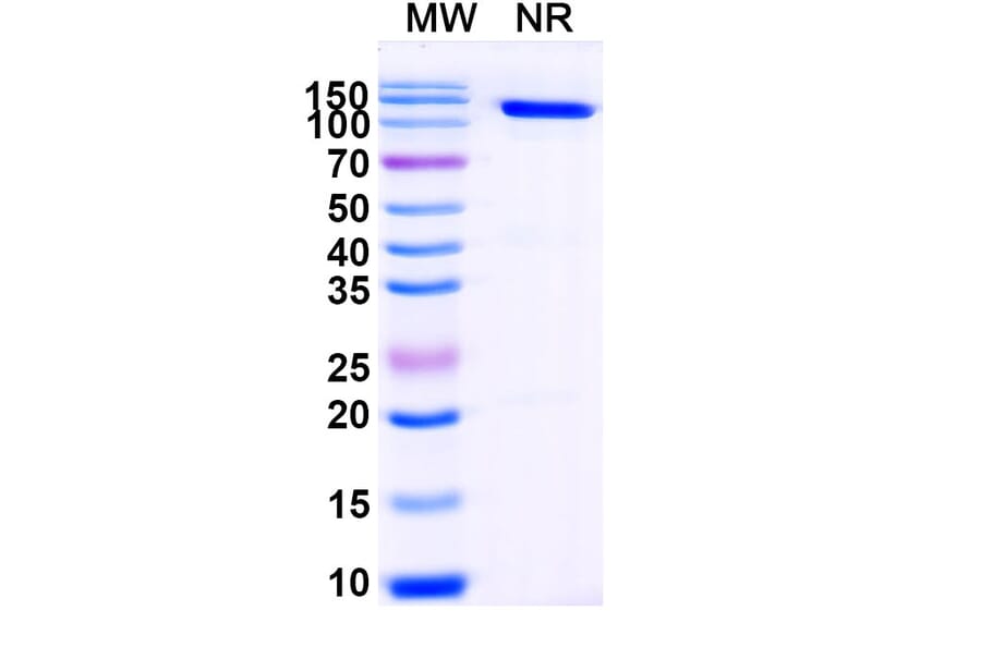 SDS-PAGE - Anti-Cortisol Nanobody [SAA1437] (A338206) - Antibodies.com