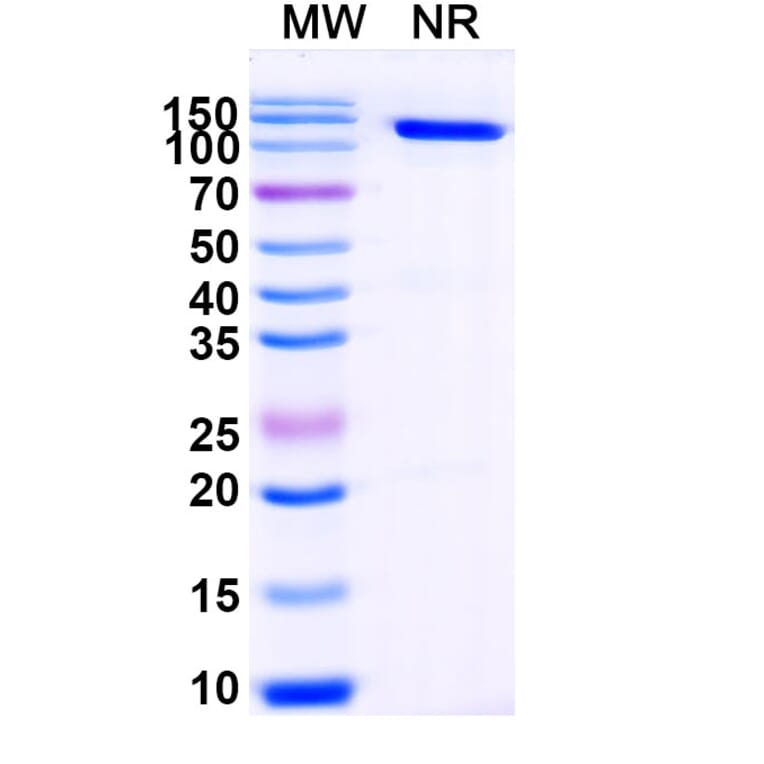 SDS-PAGE - Anti-Cortisol Nanobody [SAA1437] (A338206) - Antibodies.com