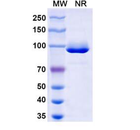 SDS-PAGE - Anti-Nucleoprotein Nanobody [VHH1] (A338210) - Antibodies.com