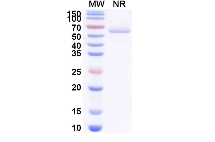 SDS-PAGE - Anti-BOTOX Nanobody [VH15] (A338211) - Antibodies.com