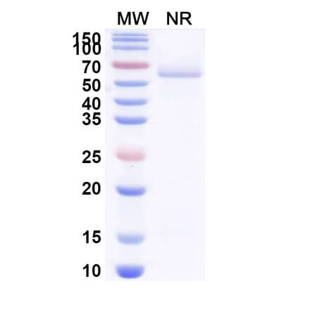 SDS-PAGE - Anti-BOTOX Nanobody [VH15] (A338211) - Antibodies.com
