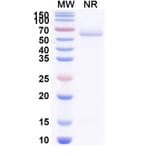 SDS-PAGE - Anti-BOTOX Nanobody [VH15] (A338211) - Antibodies.com