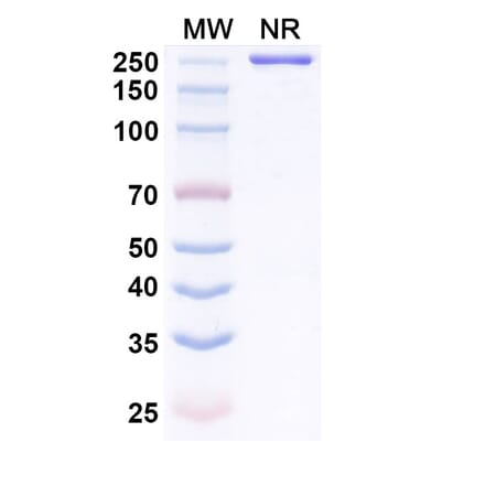 SDS-PAGE - Anti-BOTOX Nanobody [VH22] (A338212) - Antibodies.com
