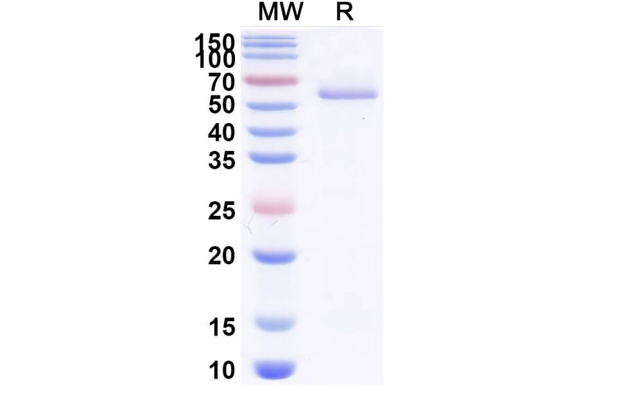 SDS-PAGE - Anti-BOTOX Nanobody [VHH17] (A338213) - Antibodies.com