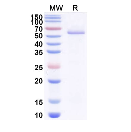 SDS-PAGE - Anti-BOTOX Nanobody [VHH17] (A338213) - Antibodies.com