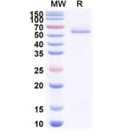 SDS-PAGE - Anti-BOTOX Nanobody [VHH17] (A338213) - Antibodies.com
