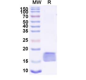 SDS-PAGE - Anti-ARC Nanobody [SAA1466] (A338215) - Antibodies.com