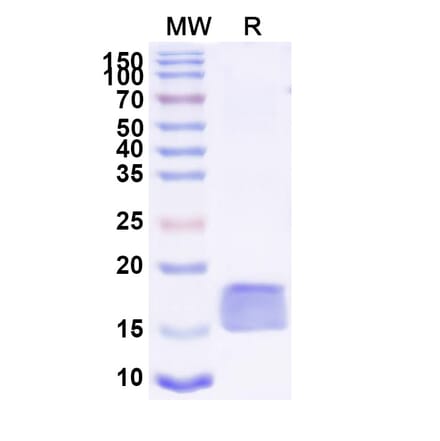 SDS-PAGE - Anti-ARC Nanobody [SAA1466] (A338215) - Antibodies.com