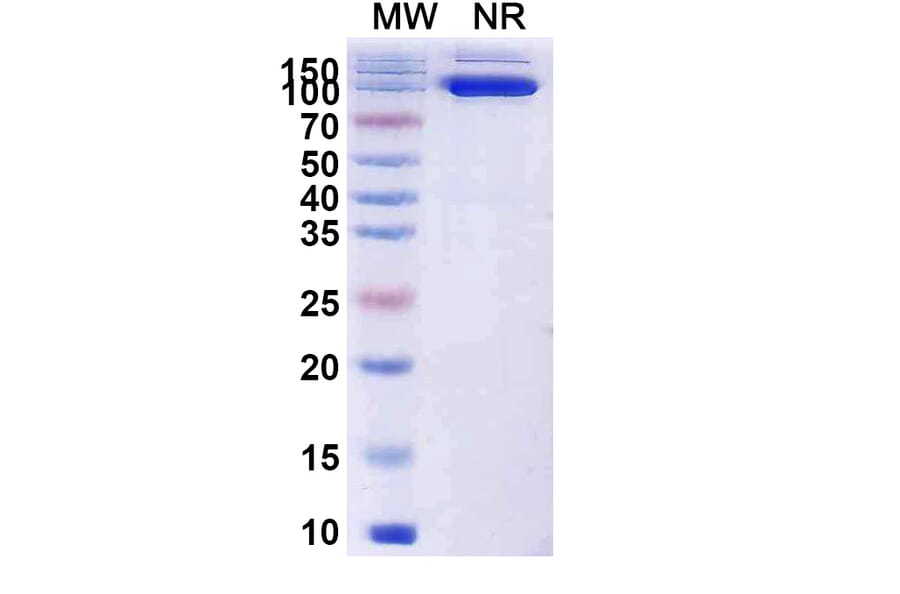 SDS-PAGE - Anti-Capsid Protein VP1 Nanobody [19B] (A338218) - Antibodies.com