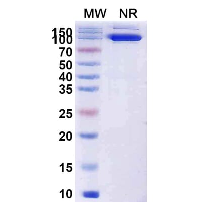 SDS-PAGE - Anti-Capsid Protein VP1 Nanobody [19B] (A338218) - Antibodies.com