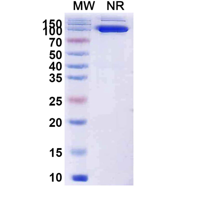 SDS-PAGE - Anti-Capsid Protein VP1 Nanobody [19B] (A338218) - Antibodies.com
