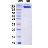 SDS-PAGE - Anti-Capsid Protein VP1 Nanobody [19B] (A338218) - Antibodies.com