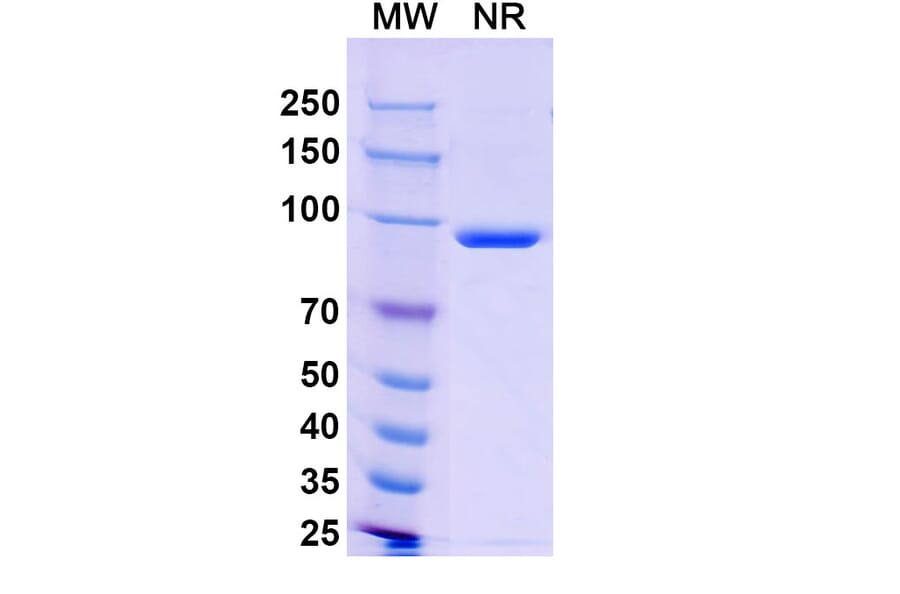 SDS-PAGE - Anti-Capsid Protein VP1 Nanobody [19B] (A338218) - Antibodies.com