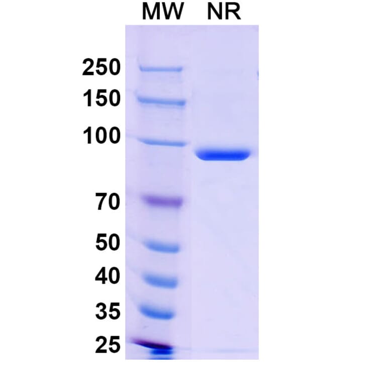 SDS-PAGE - Anti-Capsid Protein VP1 Nanobody [19B] (A338218) - Antibodies.com