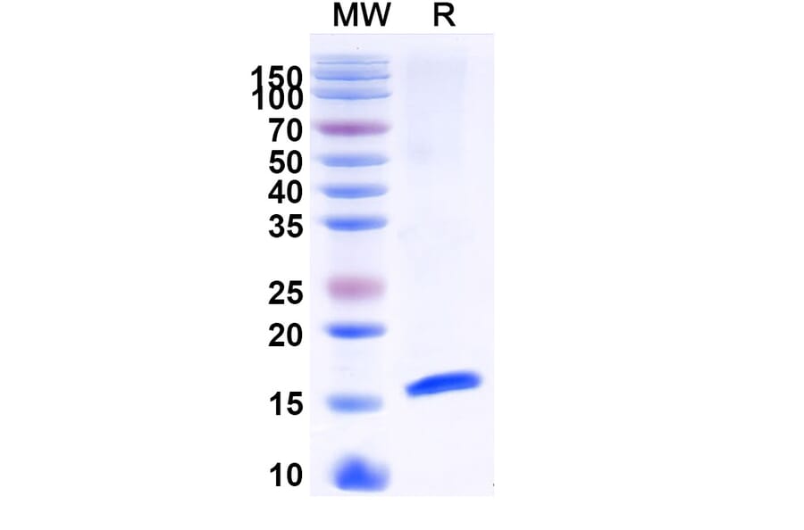 SDS-PAGE - Anti-HTR3A Nanobody [SAA1479] (A338219) - Antibodies.com