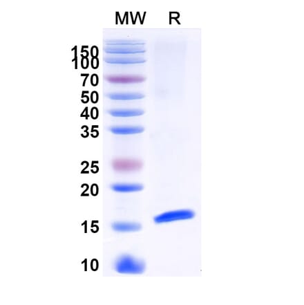 SDS-PAGE - Anti-HTR3A Nanobody [SAA1479] (A338219) - Antibodies.com