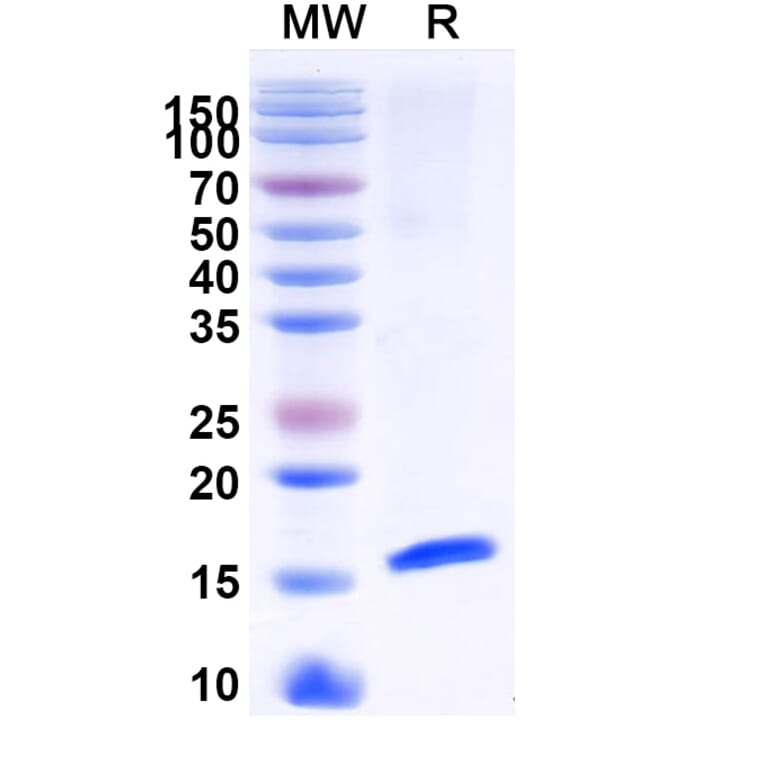 SDS-PAGE - Anti-HTR3A Nanobody [SAA1479] (A338219) - Antibodies.com