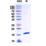 SDS-PAGE - Anti-HTR3A Nanobody [SAA1479] (A338219) - Antibodies.com