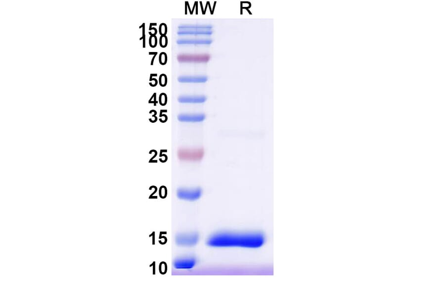 SDS-PAGE - Anti-HTR3A Nanobody [SAA1479] (A338219) - Antibodies.com
