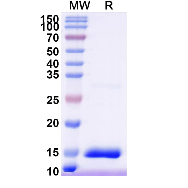 SDS-PAGE - Anti-HTR3A Nanobody [SAA1479] (A338219) - Antibodies.com