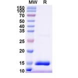 SDS-PAGE - Anti-HTR3A Nanobody [SAA1479] (A338219) - Antibodies.com