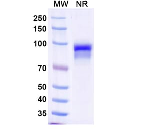 SDS-PAGE - Anti-Properdin Nanobody [SAA1485] (A338221) - Antibodies.com