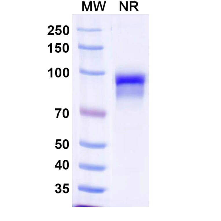 SDS-PAGE - Anti-Properdin Nanobody [SAA1485] (A338221) - Antibodies.com