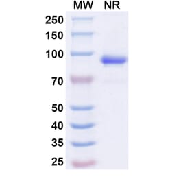 SDS-PAGE - Anti-ADAM12 Nanobody [SAA1511] (A338223) - Antibodies.com