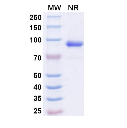 SDS-PAGE - Anti-ADAM12 Nanobody [SAA1511] (A338223) - Antibodies.com