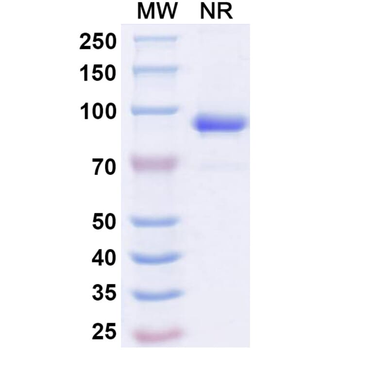 SDS-PAGE - Anti-ADAM12 Nanobody [SAA1511] (A338223) - Antibodies.com