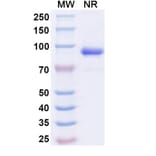 SDS-PAGE - Anti-ADAM12 Nanobody [SAA1511] (A338223) - Antibodies.com