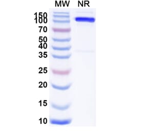 SDS-PAGE - Anti-SLC4A7 Nanobody [SAA1974] (A338224) - Antibodies.com