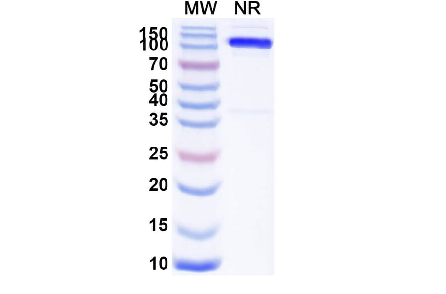 SDS-PAGE - Anti-SLC4A7 Nanobody [SAA1974] (A338224) - Antibodies.com