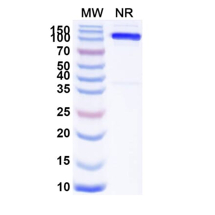 SDS-PAGE - Anti-SLC4A7 Nanobody [SAA1974] (A338224) - Antibodies.com