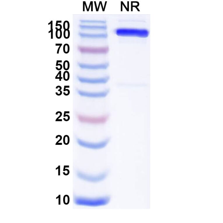 SDS-PAGE - Anti-SLC4A7 Nanobody [SAA1974] (A338224) - Antibodies.com