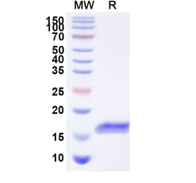 SDS-PAGE - Anti-Glypican 3 Nanobody [HN3] (A338226) - Antibodies.com