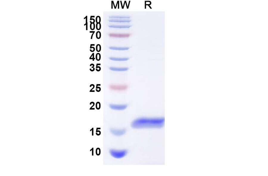 SDS-PAGE - Anti-Glypican 3 Nanobody [HN3] (A338226) - Antibodies.com