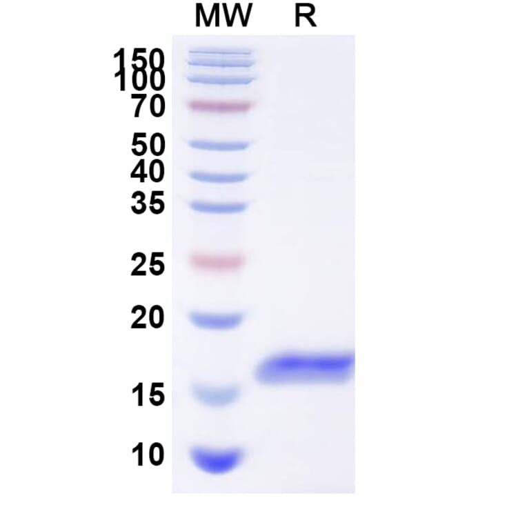 SDS-PAGE - Anti-Glypican 3 Nanobody [HN3] (A338226) - Antibodies.com